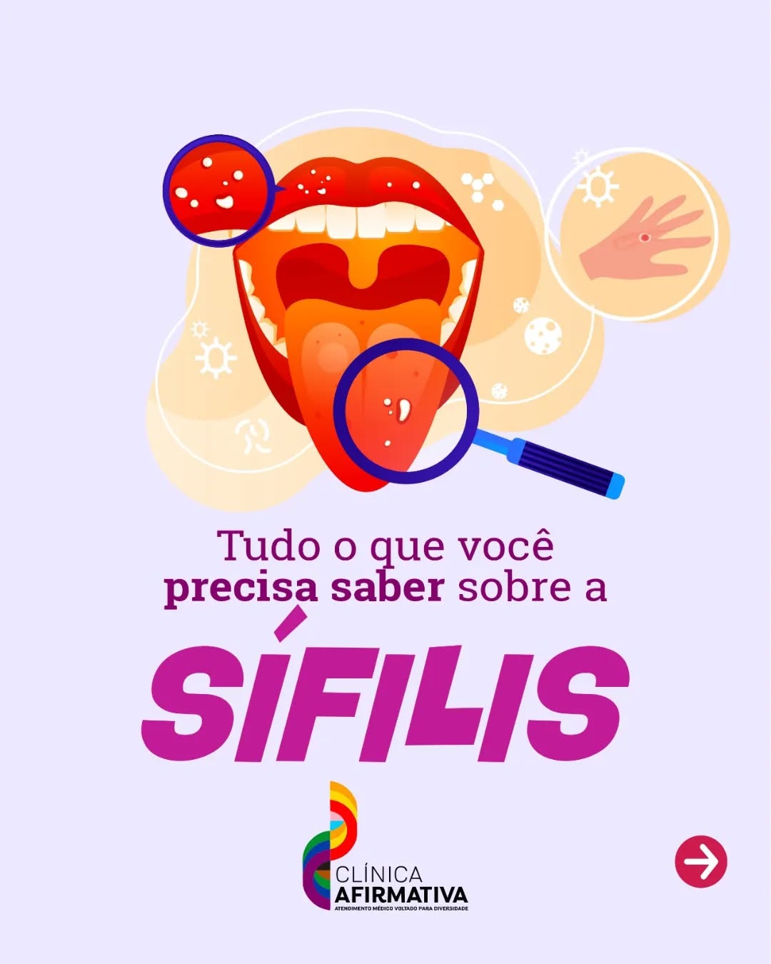 sílifis